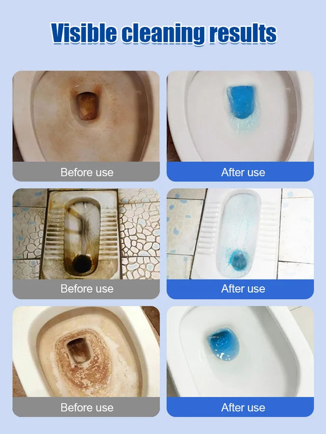 🔥🔥【🔥Горещи разпродажби🔥3 кутии】 Мощна пяна за почистване на тоалетни чинии